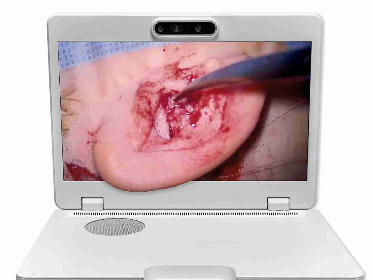 达擎之＂Heads-up 3D显微手术显示系统＂，，，整合4K裸眼3D显示及眼球追踪系统，，，，具备快速追踪人眼移动位置功能，，，减轻医师长时间维持固定姿势的负担，，让医师能有更宽广清晰的3D立体视野及更舒适的姿势来执行手术。。。